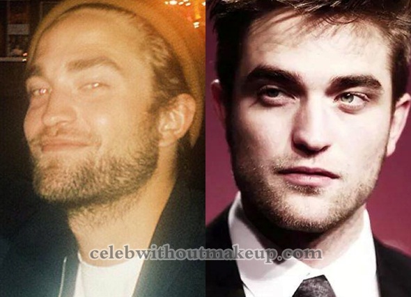 Robert Pattinson Without Makeup