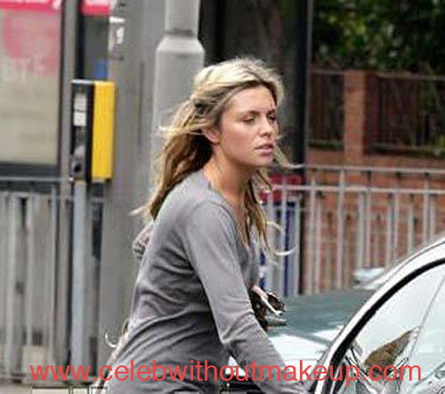 Abbey Clancy No Makeup On