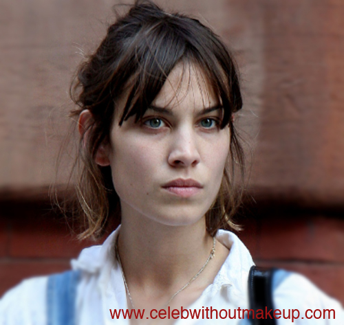 Alexa Chung Celeb Without Makeup 1