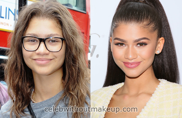 Zendaya No Makeup