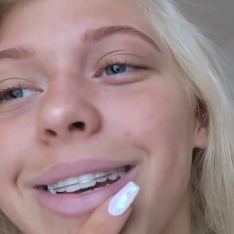 A close-up of Loren Gray without makeup
