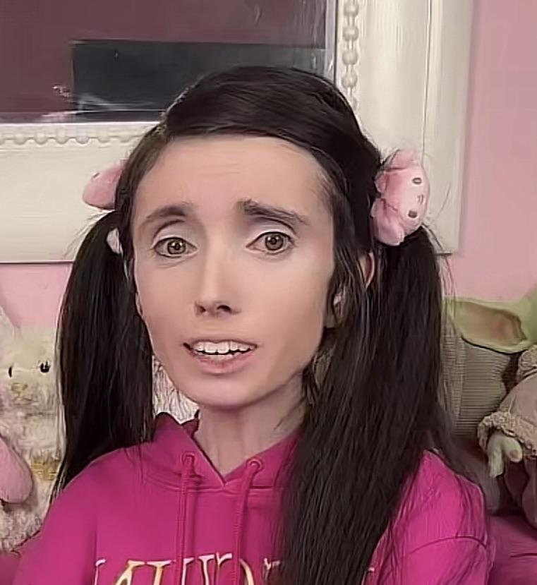 Eugenia Cooney With Minimal Makeup