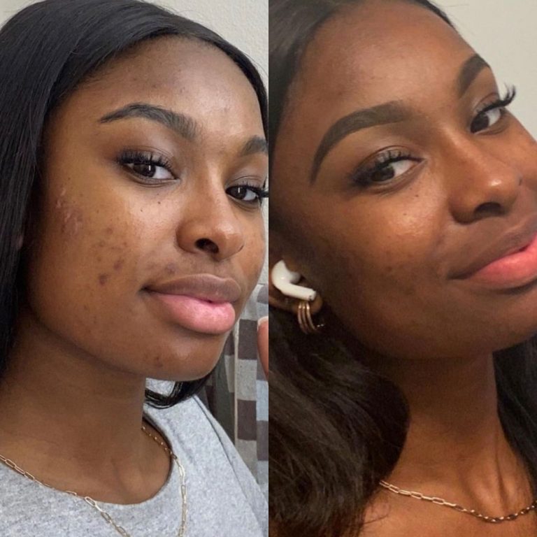 Coco Jones With Minimal Makeup