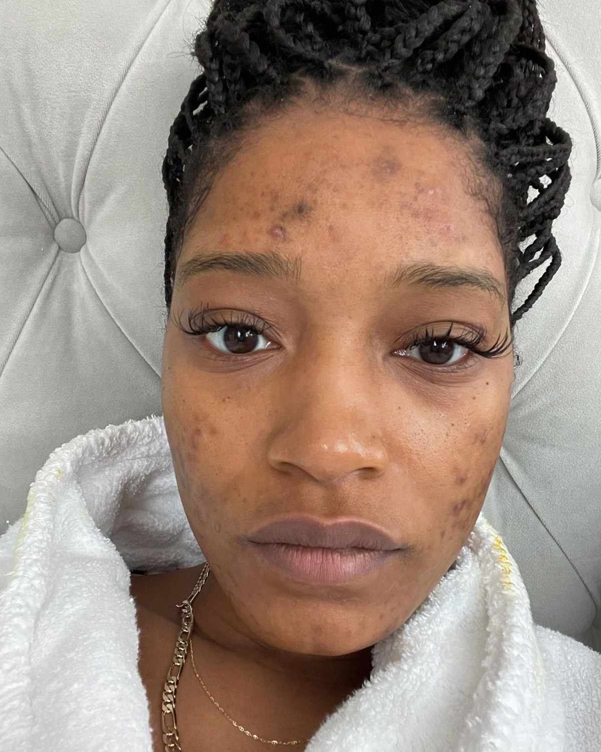 Keke Palmer Without Makeup